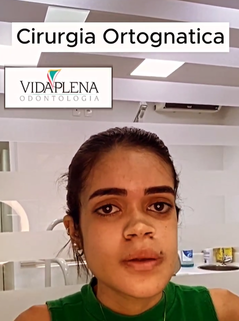 Cirurgia Ortognática