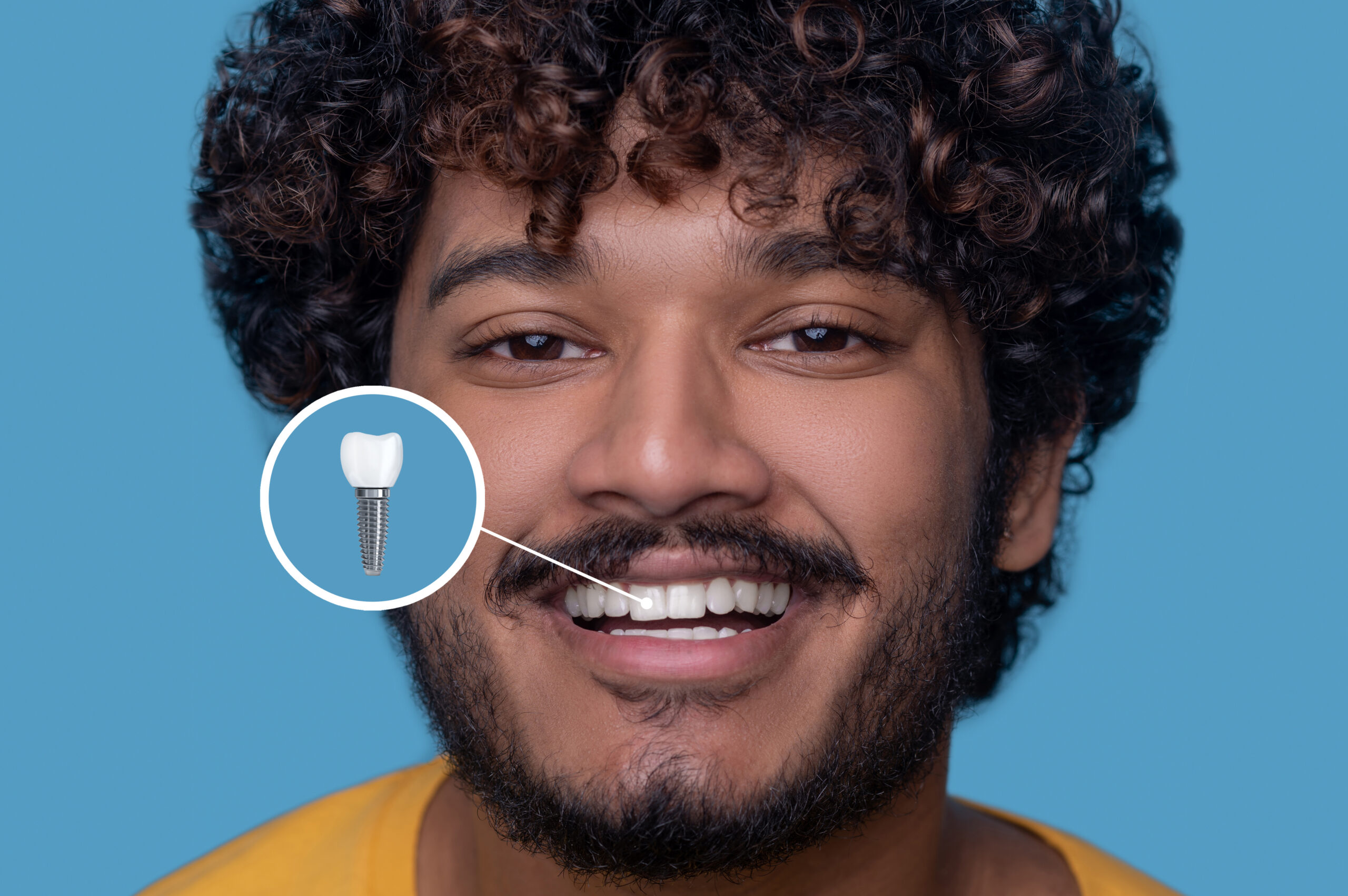 Implantes Dentários VidaPlena