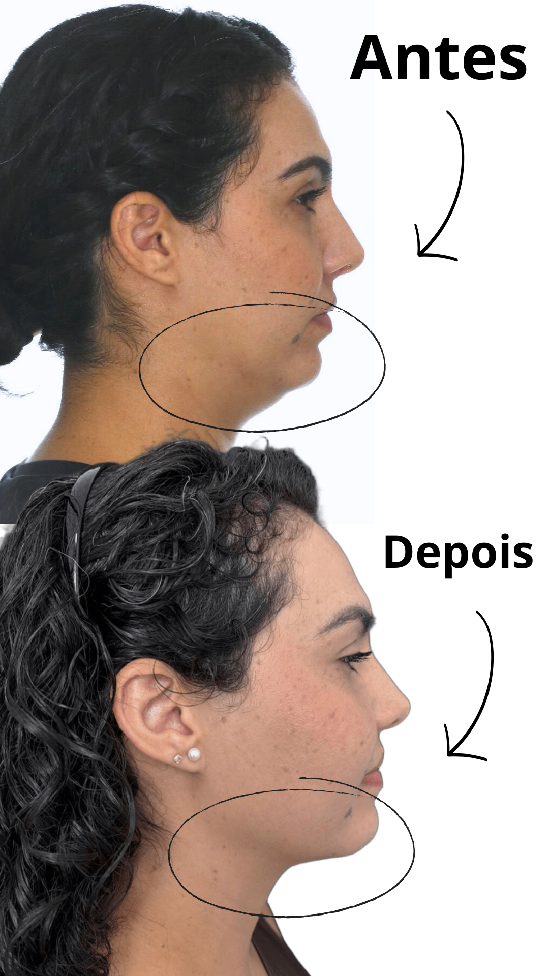 Caso Clínico Funcional 1