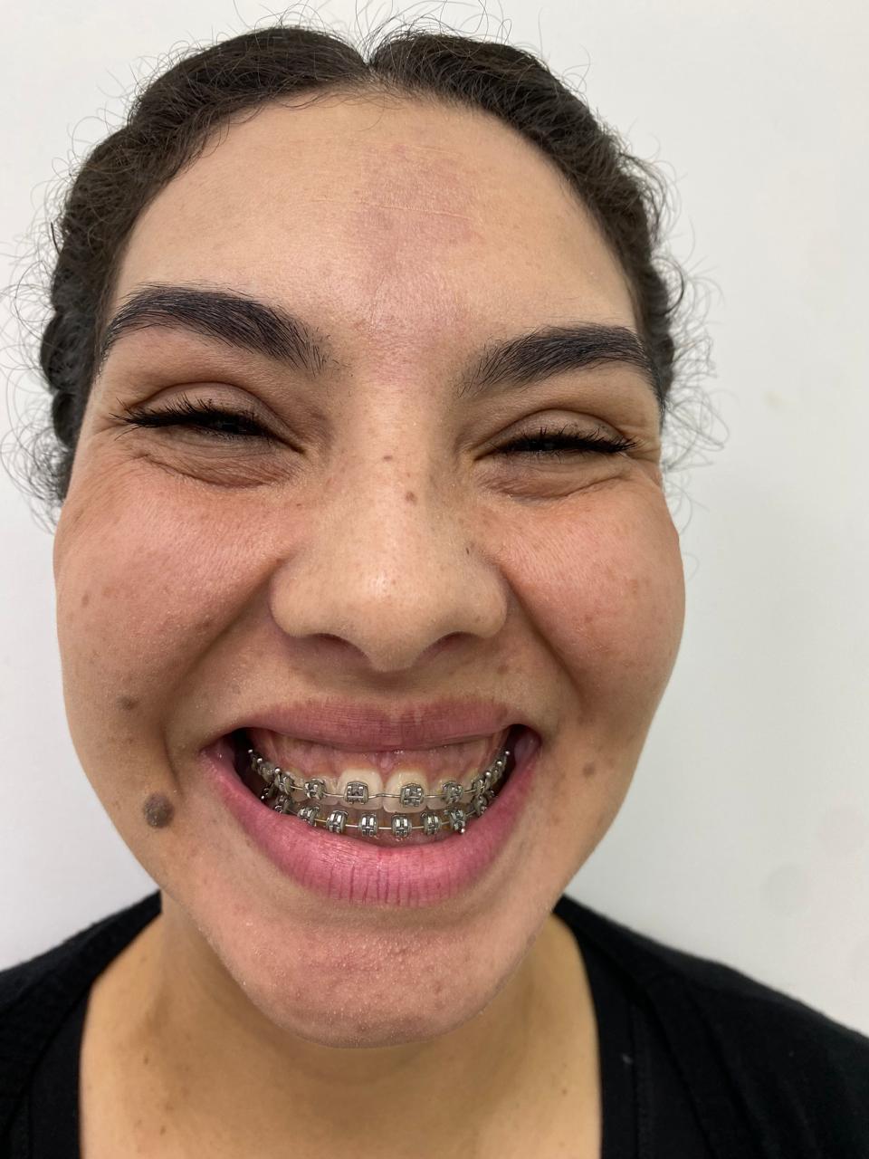 Caso Clínico Funcional 3