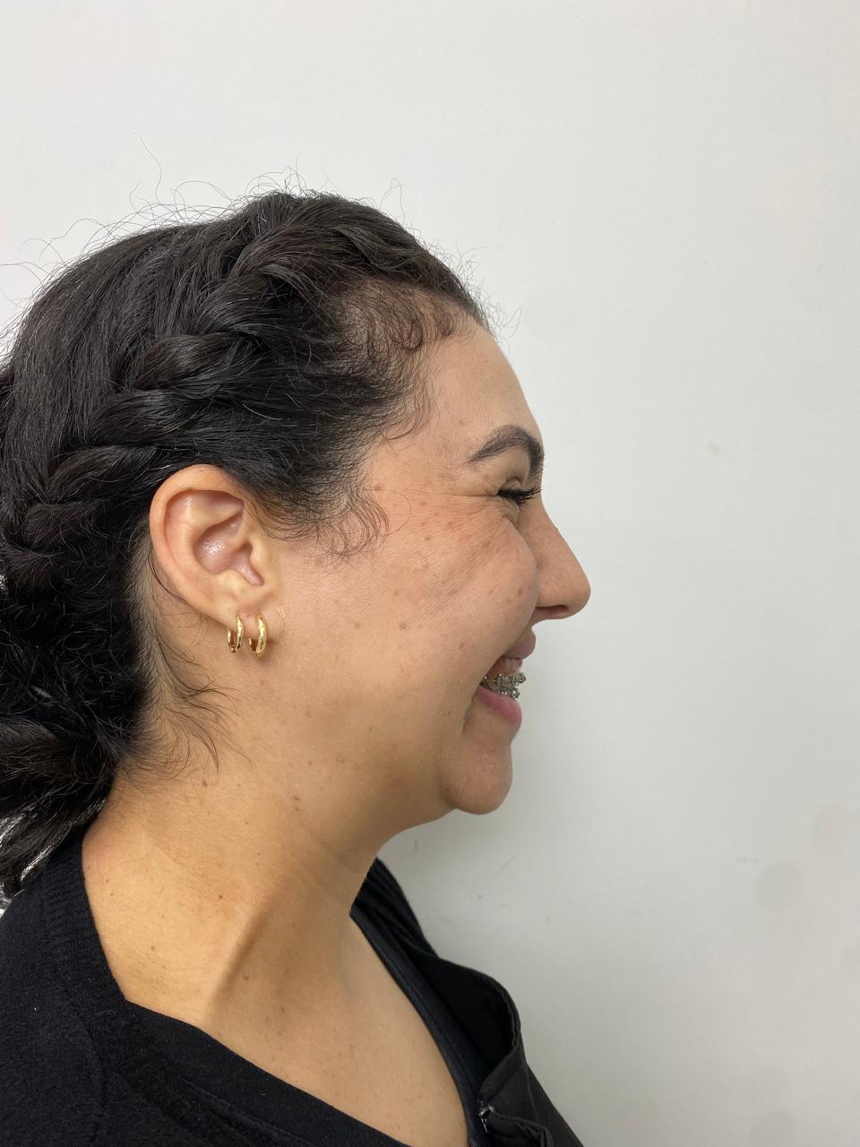 Caso Clínico Funcional 2