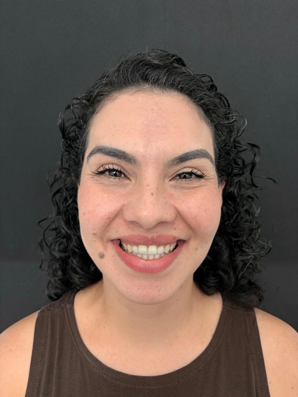 Caso Clínico Funcional 4